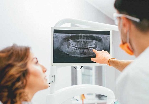 Chụp X quang răng là gì và những điều bạn cần biết | TCI Hospital