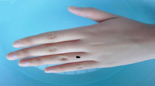 Nốt ruồi ở ngón tay áp út có ý nghĩa gì?